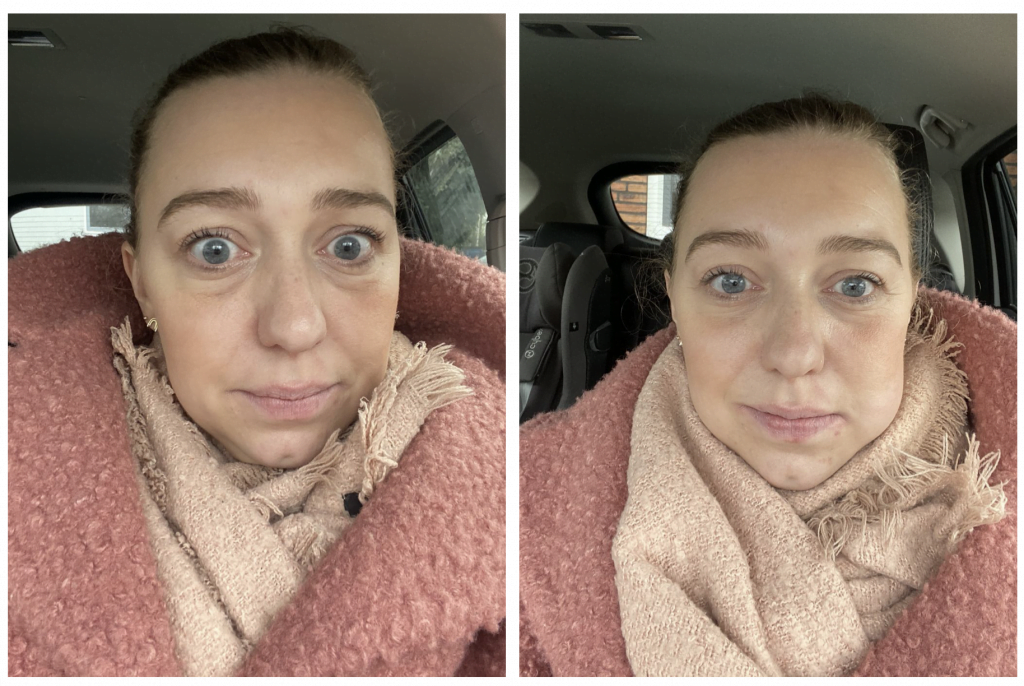 verstandskies trekken tips